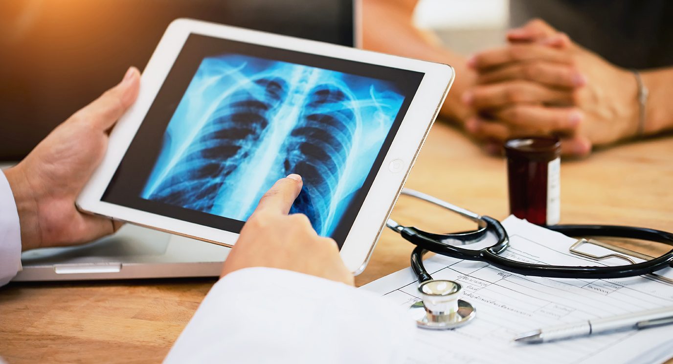 Doctor explaining the results of a lung x-ray to a patient