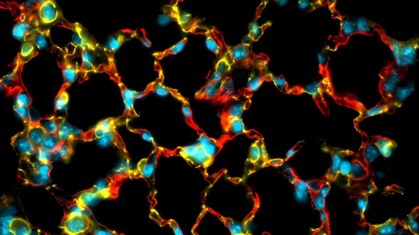 Immunofluorescence image of regenerating lung tissue showing gas-exchanging alveolar epithelial cells (red), epithelial cells (yellow) and nuclei (light blue). Image courtesy of Bongjun Kim, Ph.D. and Jae-Il Park, Ph.D.