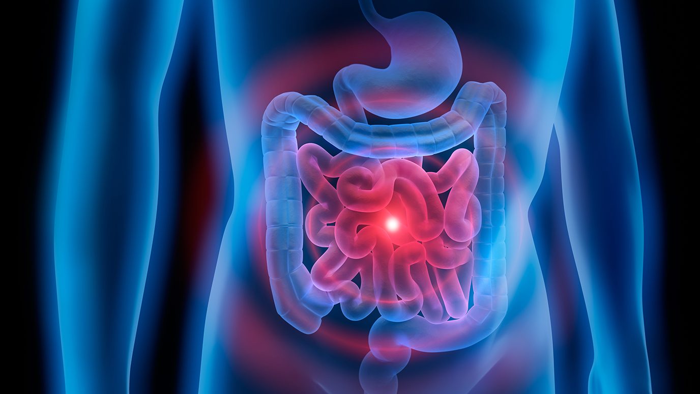 Image of colon being targeted