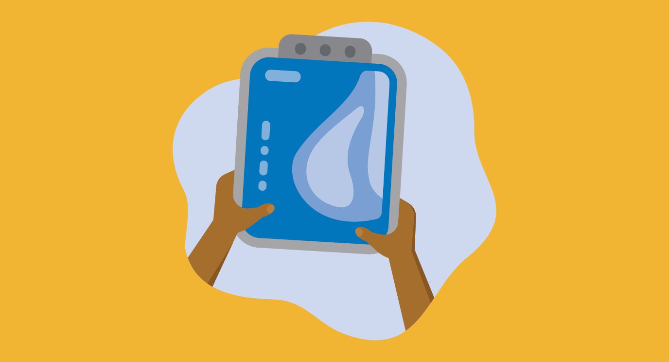 Illustration of an x-ray looking at breast tissue