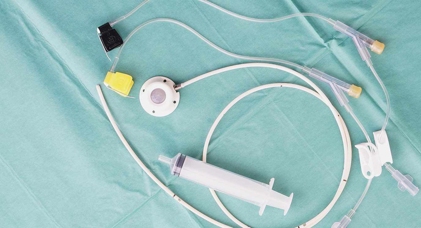 Image of a chemotherapy port and catheter