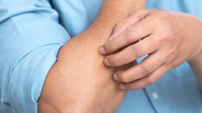 A white male scratches his arm