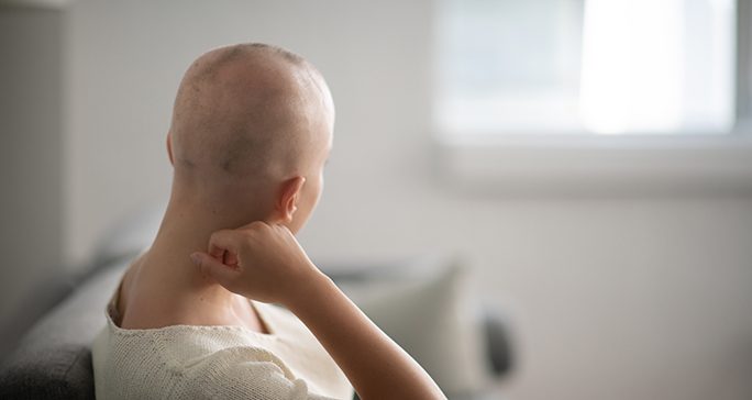 Person with patchy bald head, seated with her back turned to viewer in a white living room