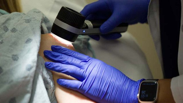A doctor examines a patient's arm with a dermoscope