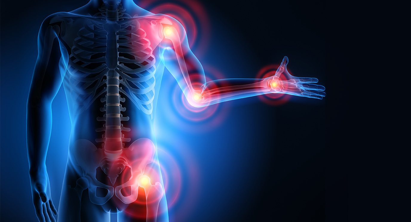 Illustration of tumors lit up on a human body