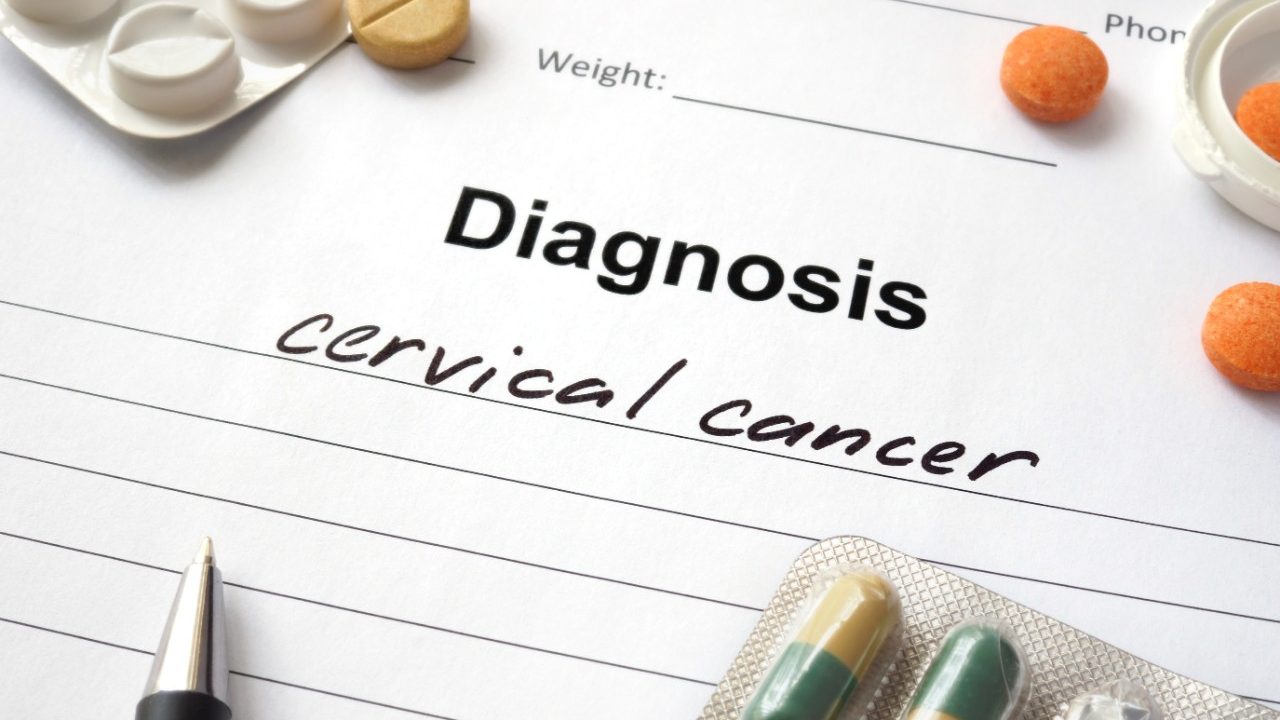 Cancerwise blog post: Learn about cervical cancer myths