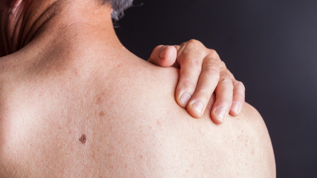 Cancerwise blog post: Understanding skin changes during cancer treatment