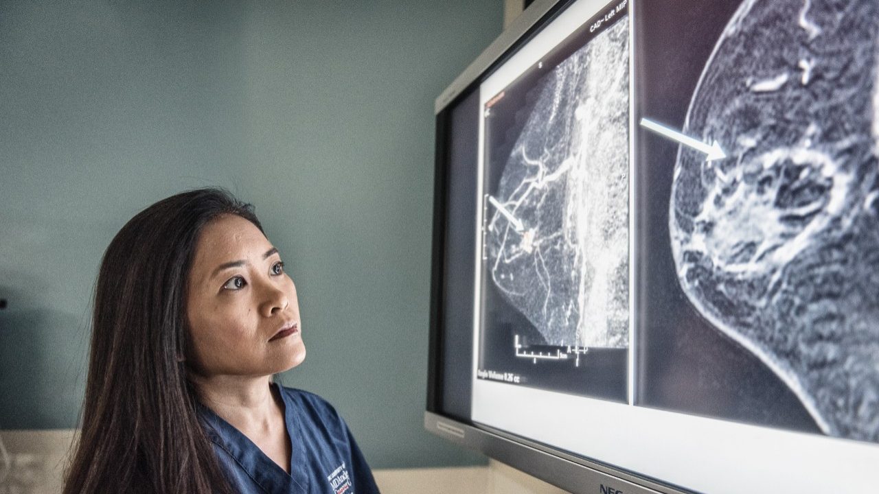 Cancerwise blog post: Breast cancer, spinal tumors clinical trials provide promise for future cancer treatment methods