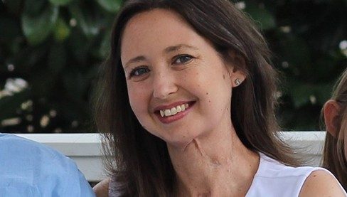 Oral cancer survivor Jeannie Hopper