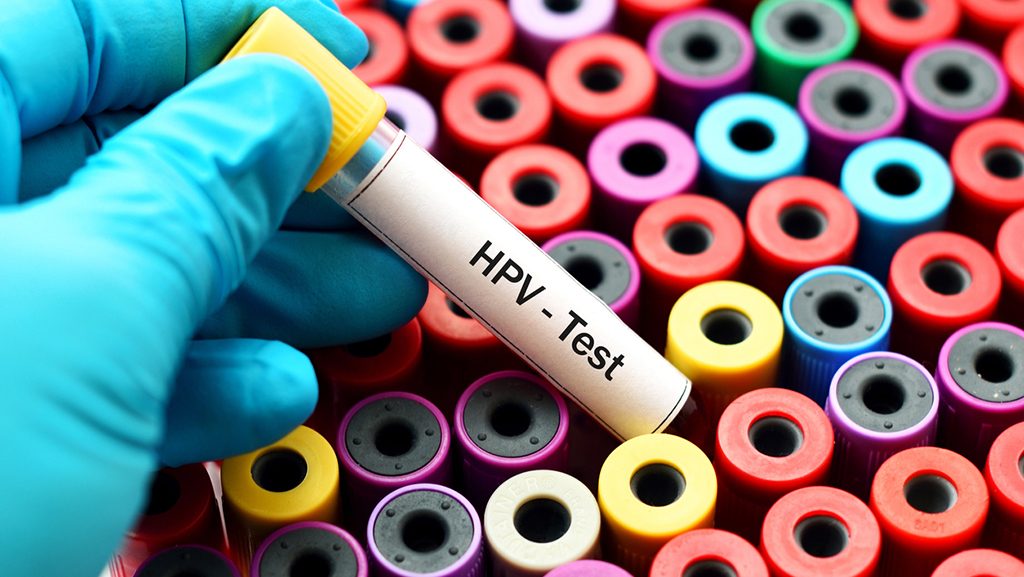 Gloved hand holding vial labeled "HPV test"