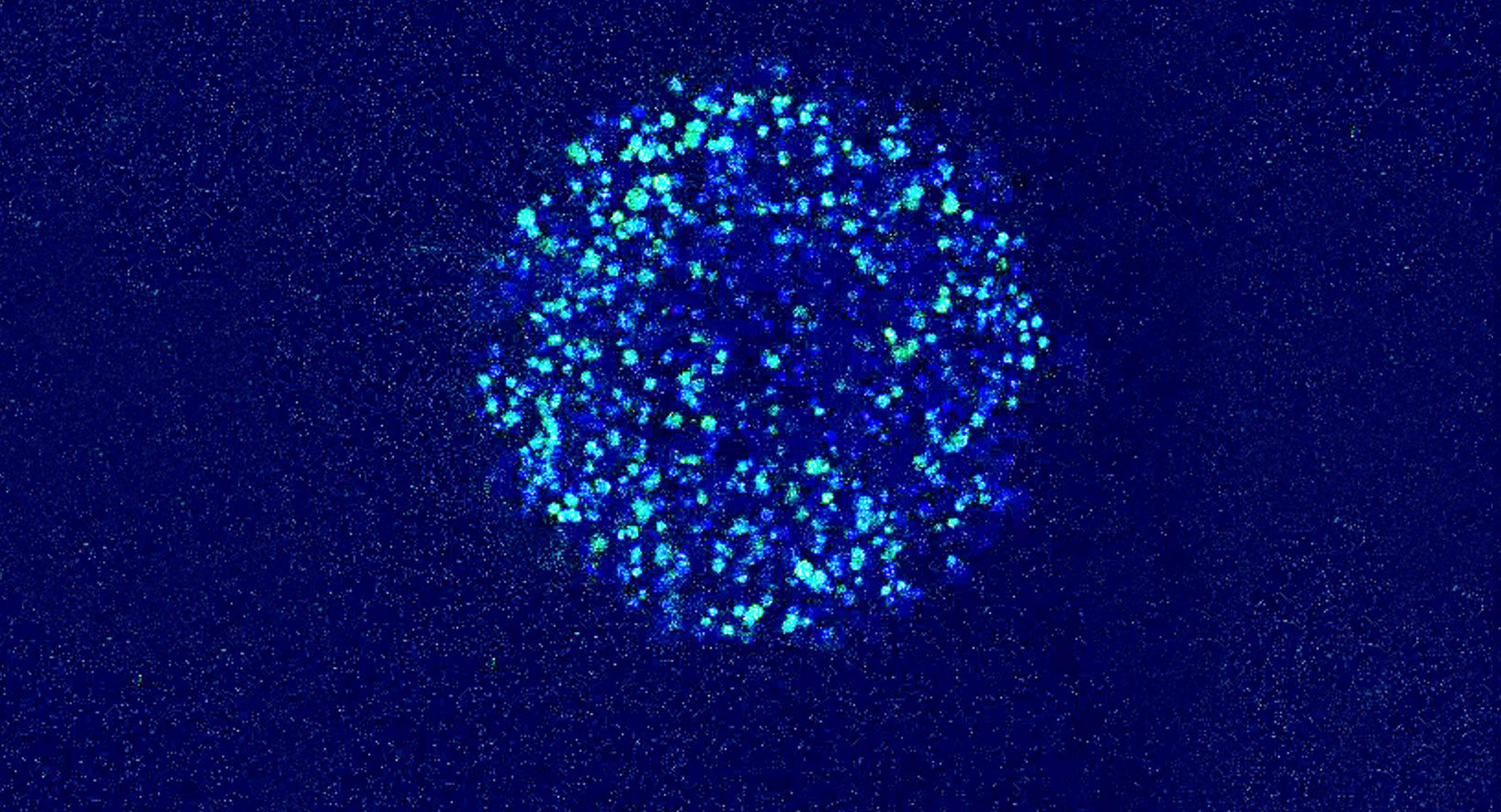Microscopic image of tumor cells encapsulated in alginate bed, used to evaluate hyperpolarized C-13 pyruvate to C-13 lactate in hundreds of live cells simultaneously by MRS.