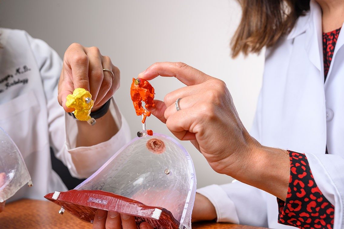 Doctors holding 3D model of breast and tumor