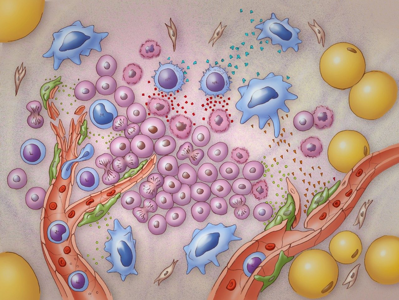Medical illustration of the tumor microenvironment