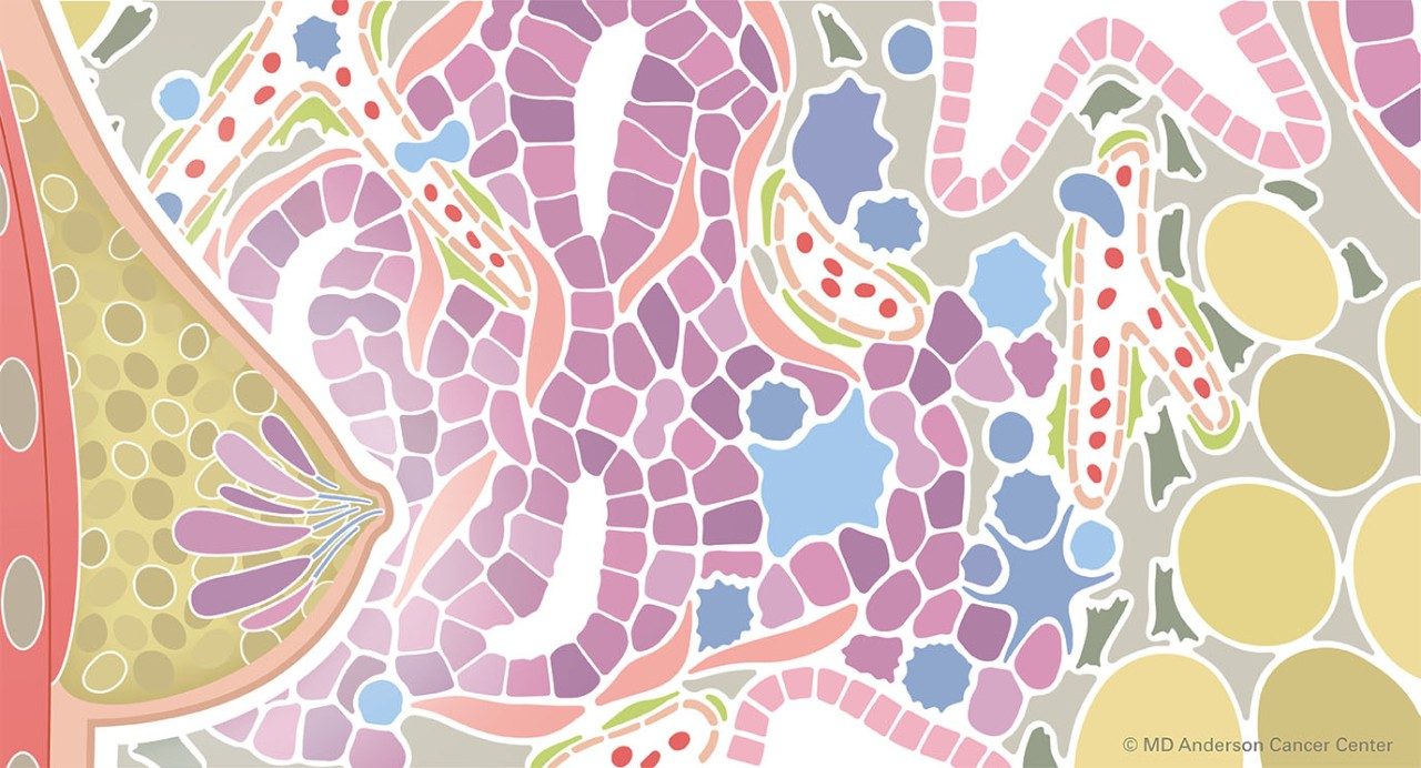 Colorful illustration of breast with lobules in front of a depiction of the tumor microenvironment