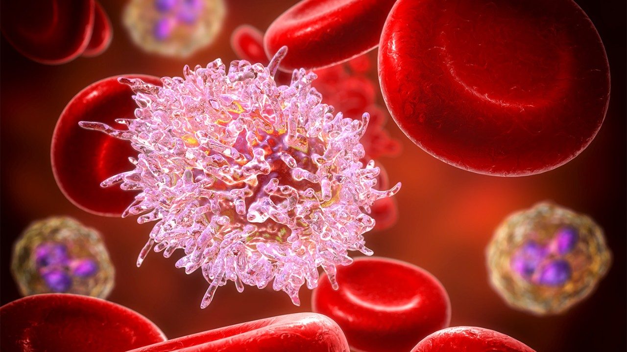 Close-up medical illustration of hairy cell leukemia in the bloodstream