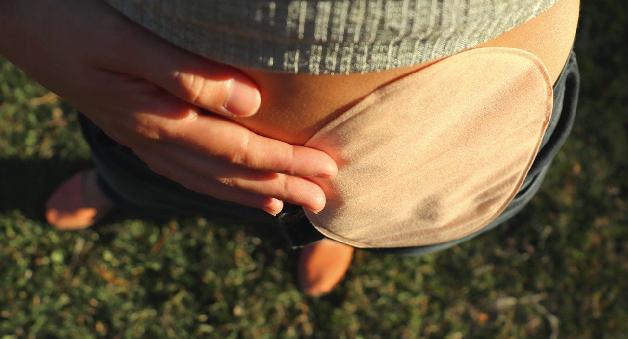 Bird's-eye zoomed view of a white person's hand holding a beige, opaque colostomy bag flat against an exposed belly, with jeans, grass and feet in the background