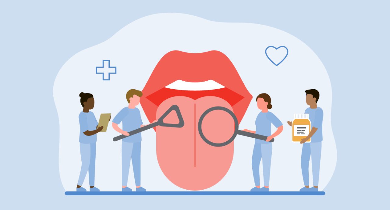 Cartoon-style drawing of four tiny doctors examining an enormously oversized tongue with giant instruments
