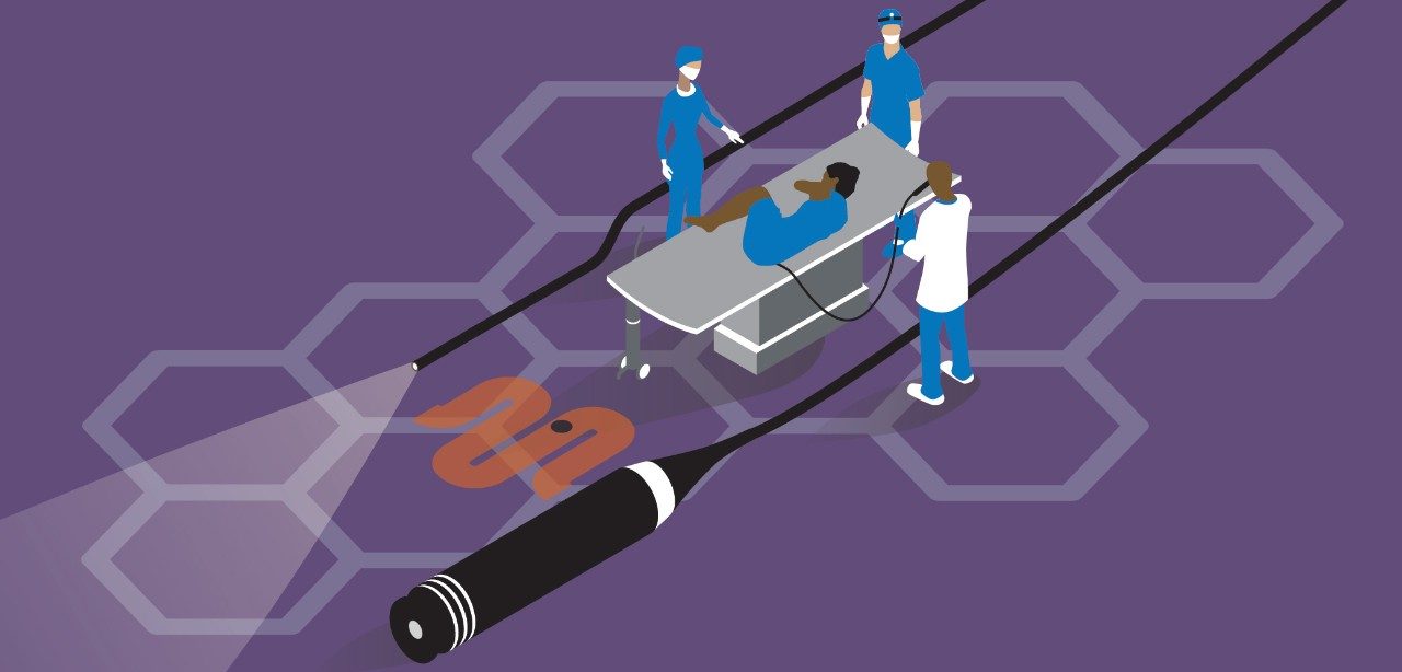 An illustration of a colonoscopy procedure
