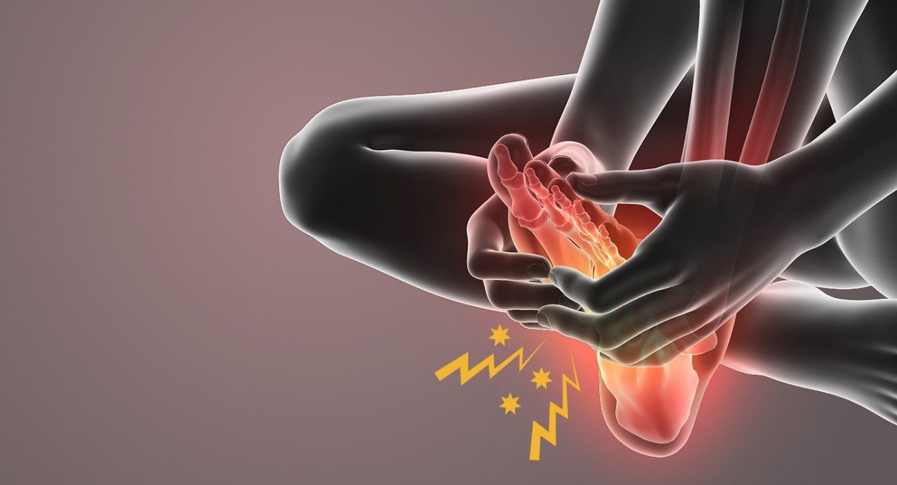Illustration of a person grabbing their foot with stars and jagged bolts coming from the foot to represent neuropathy.