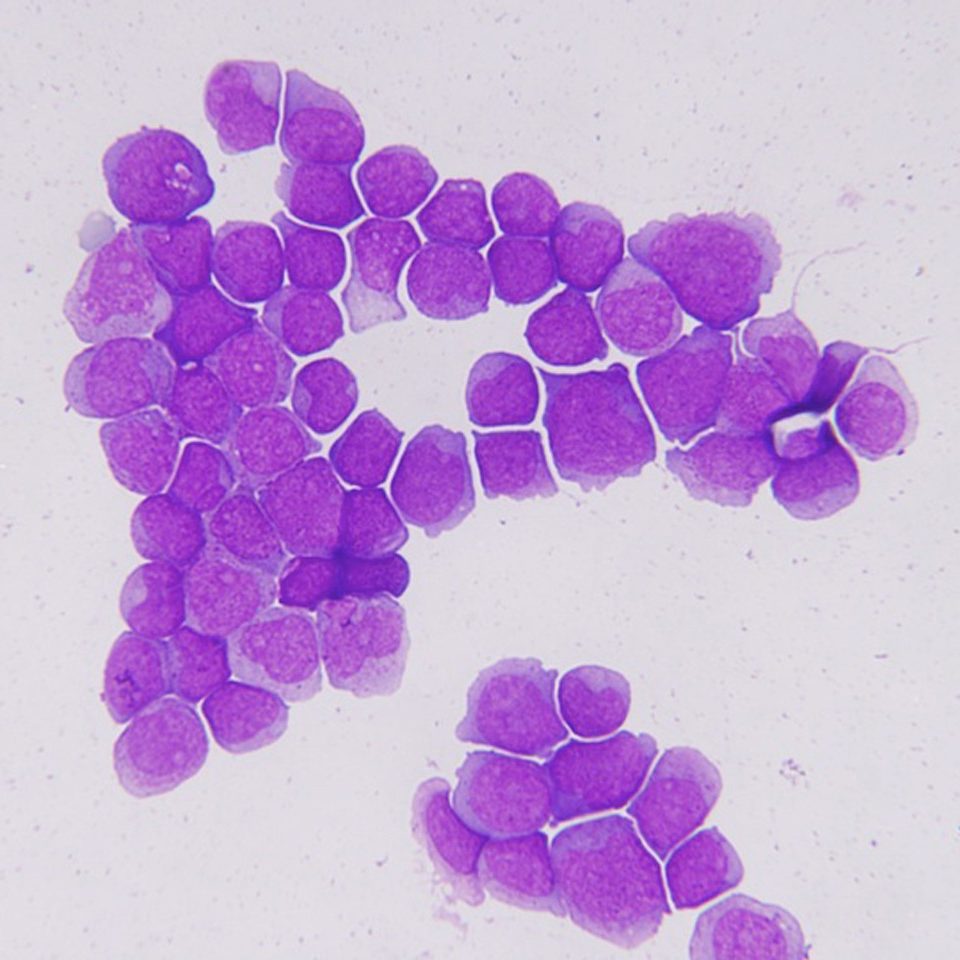 Leukemia research slide