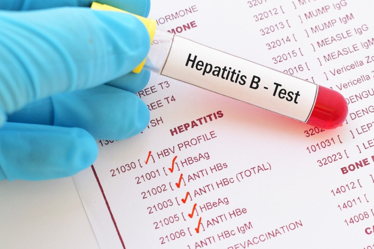 Hepatitis blood test