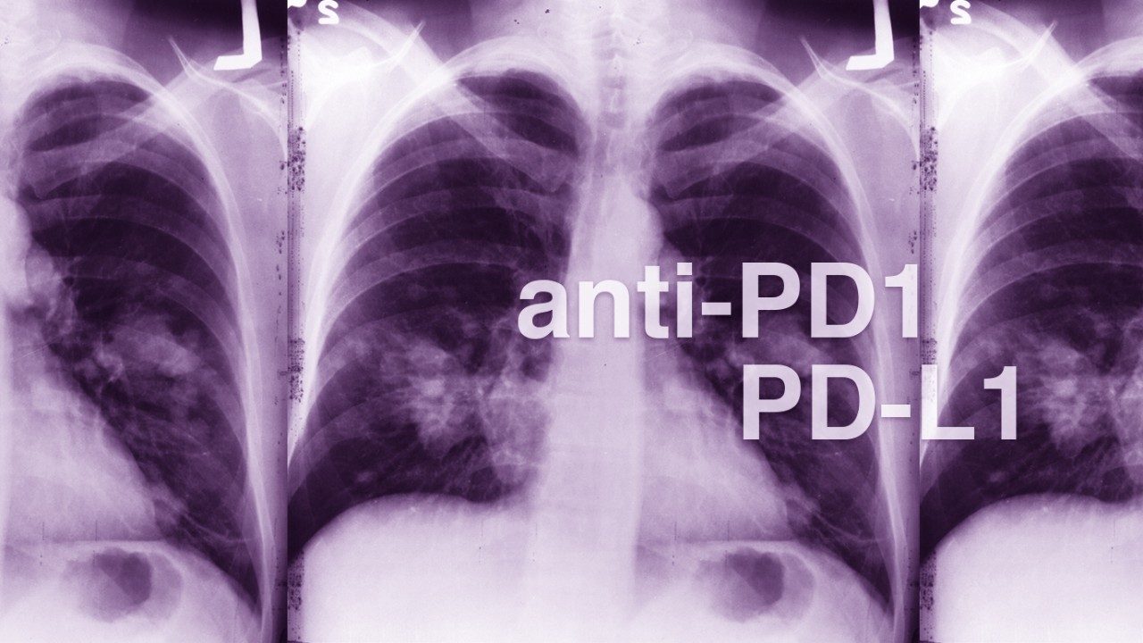 lung imaging