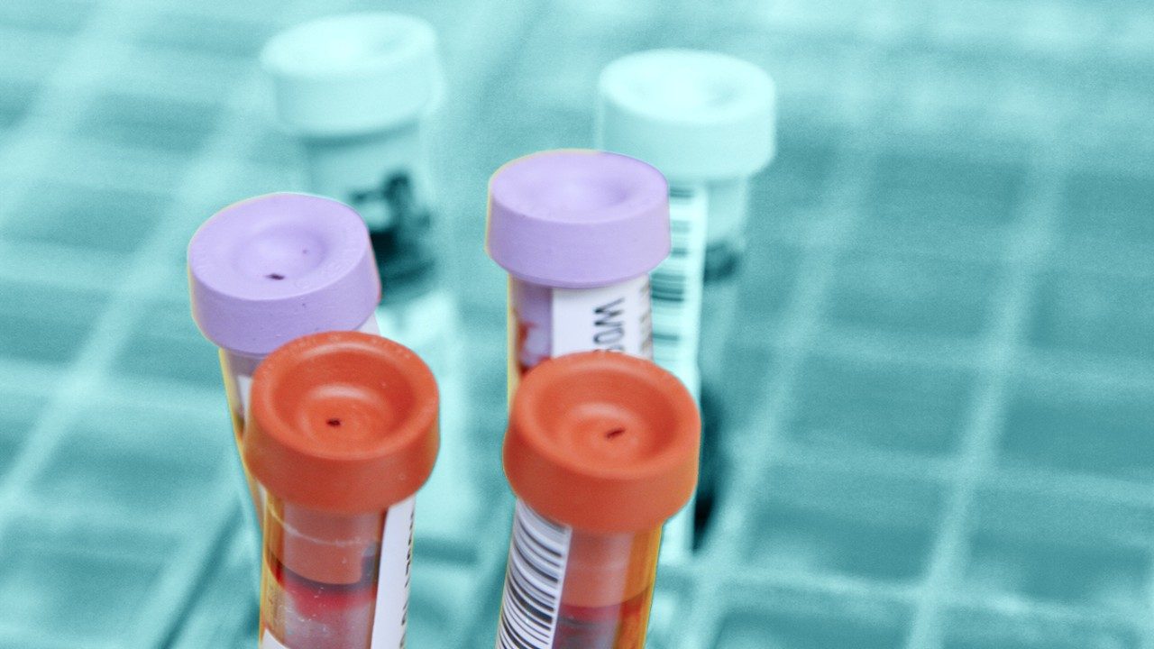 blood sample