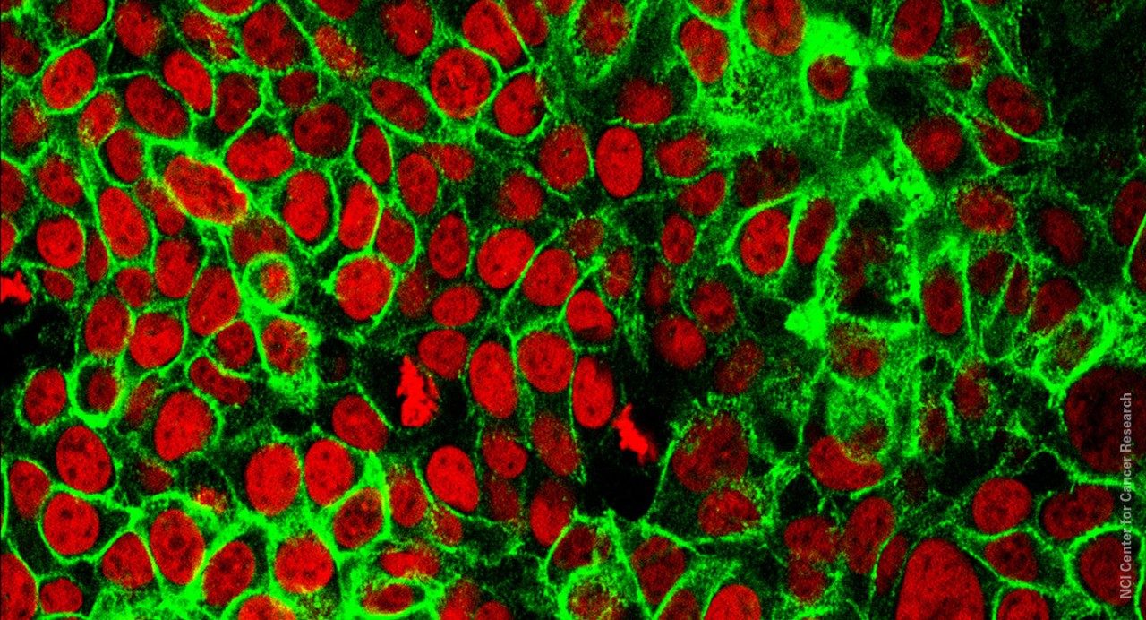 Colorectal cancer cells
