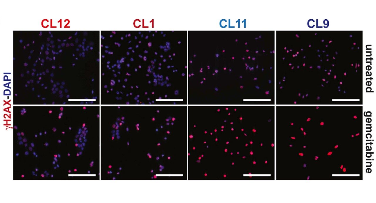Pancreatic cancer cells