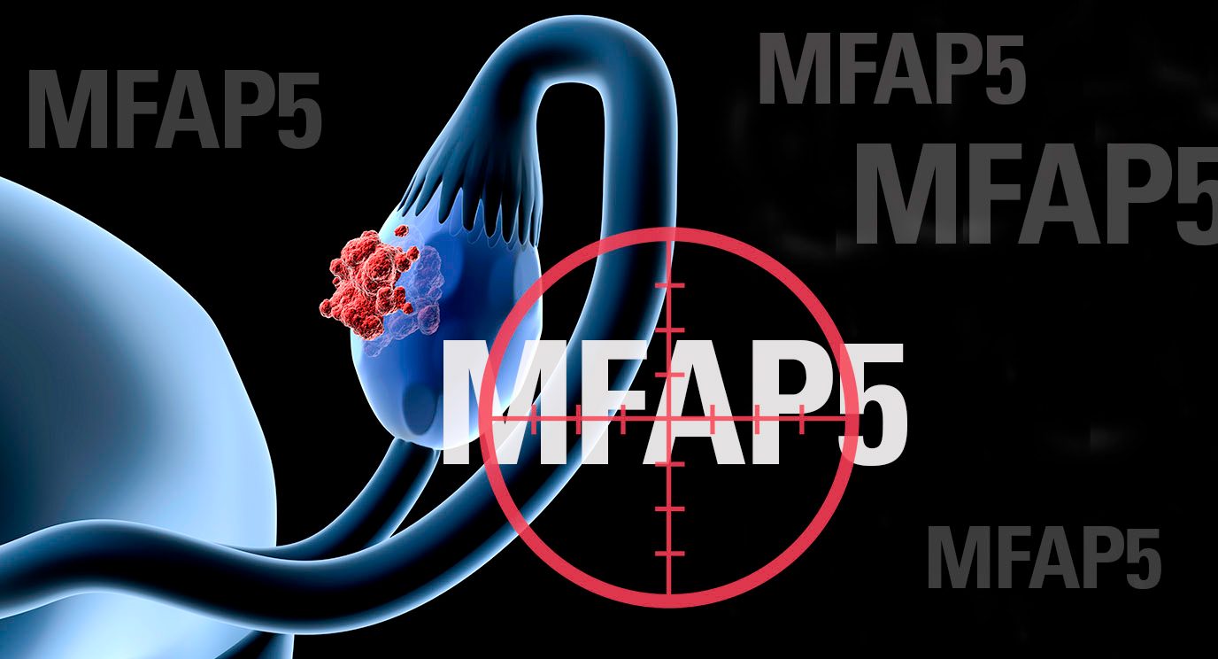 Researchers have found that targeting the MFAP5 protein in mouse models reduces the fibrosis involved in ovarian and pancreatic cancers.