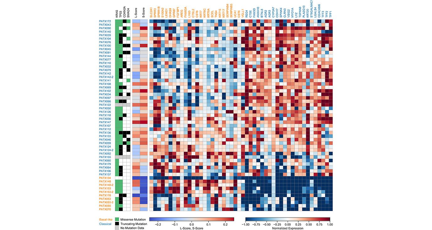 Gene expression signature identified in the study allows pancreatic cancers stratification based on KRAS dependency
