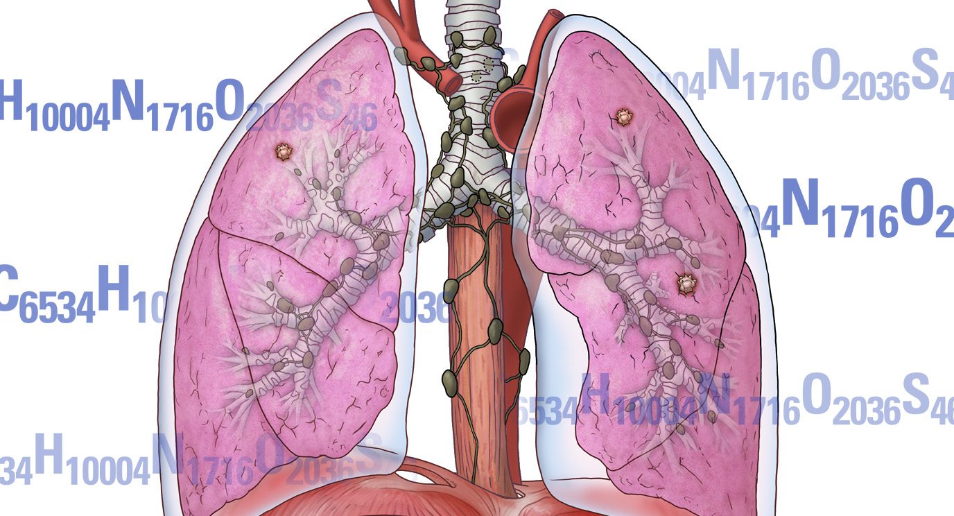 An immunotherapy clinical trial uses the immune checkpoint blockade drug pembrolizumab against precancerous growths to prevent their evolution to lung cancer.