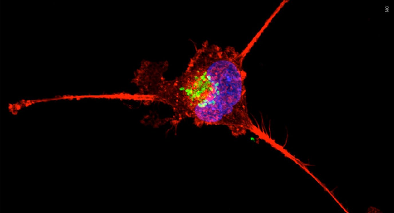 A triple-negative breast cancer cell in the process of dying under attack from a combination of drugs in a laboratory experiment. Image: National Cancer Institute 