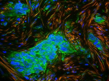  Fibroblasts undergoing epigenetic reprogramming 