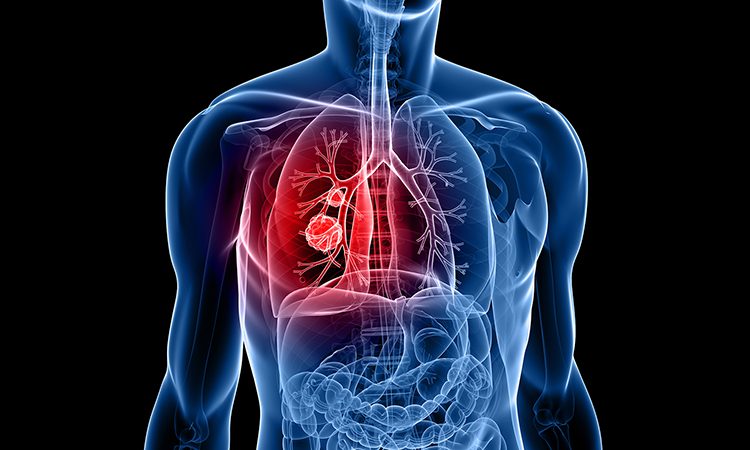 rendering of upper abdomen
