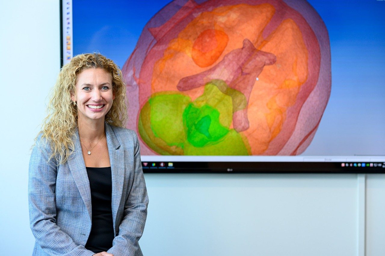Dr. Brock with image of brain created by HyperWorks Software