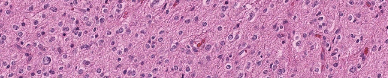 Purple imaging