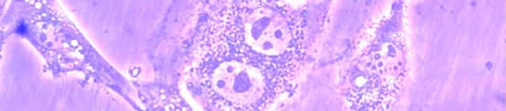 Happy cells under the microscope