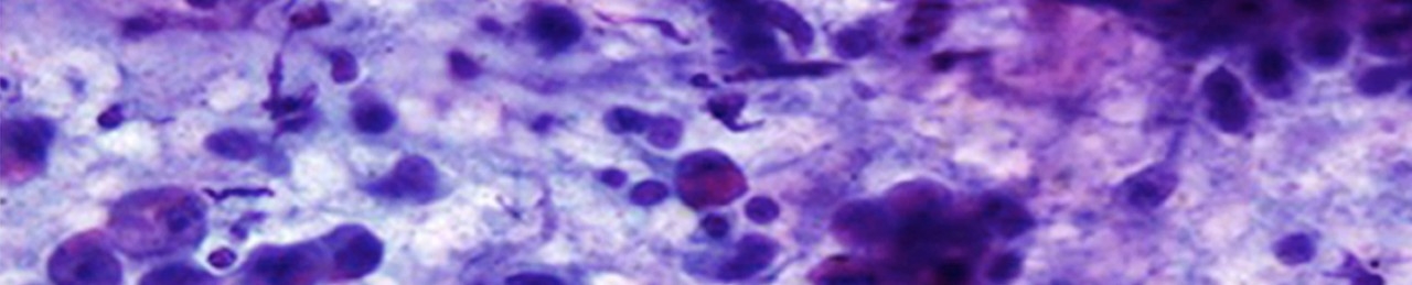 Calin Laboratory 