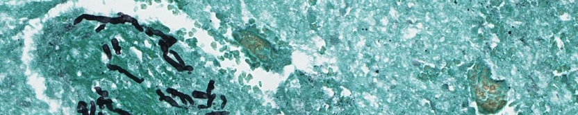 Dr. Kontoyiannis Cell