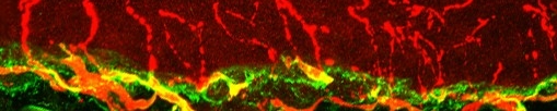 Mouse intraepidermal nerve fibers