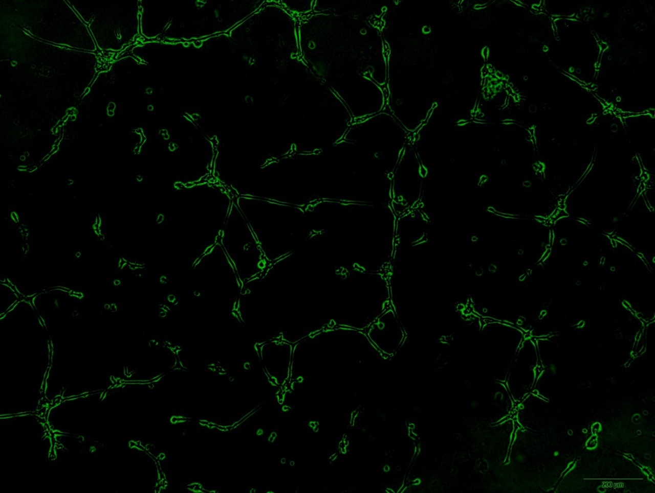 Human Umbilical Vein Endothelial Cells stimulated with human basic fibroblast growth factor for 20 hours