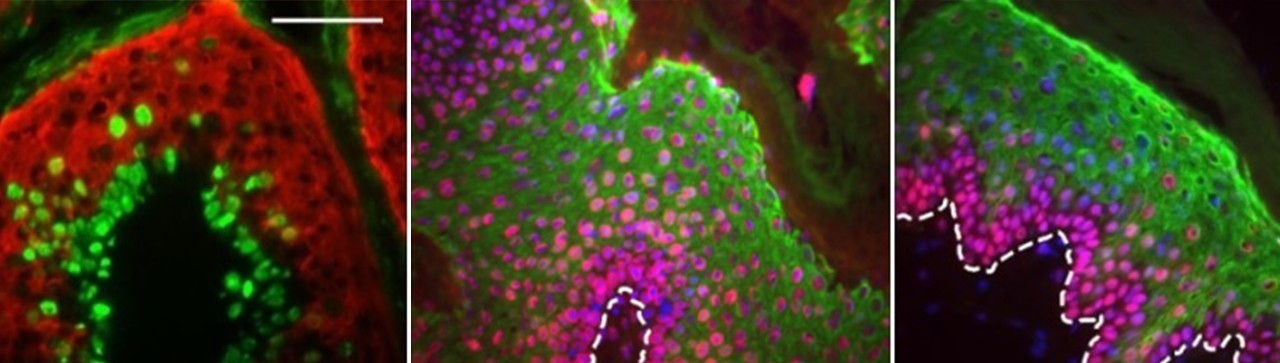 HPV-positive versus HPV-negative imaging