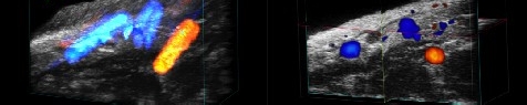 SAIF research image